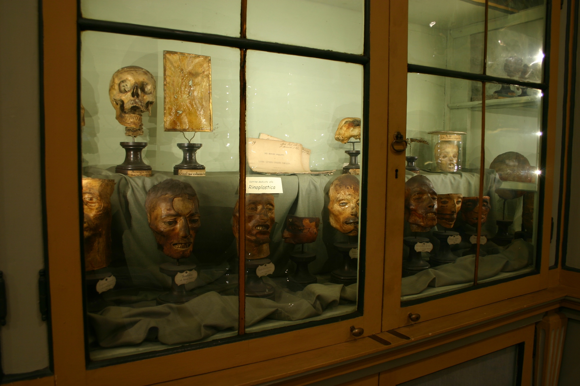 Rhinoplasty section of Luigi Porta anatomical collection, Museo per la Storia dell'Università, Pavia - 01.JPG